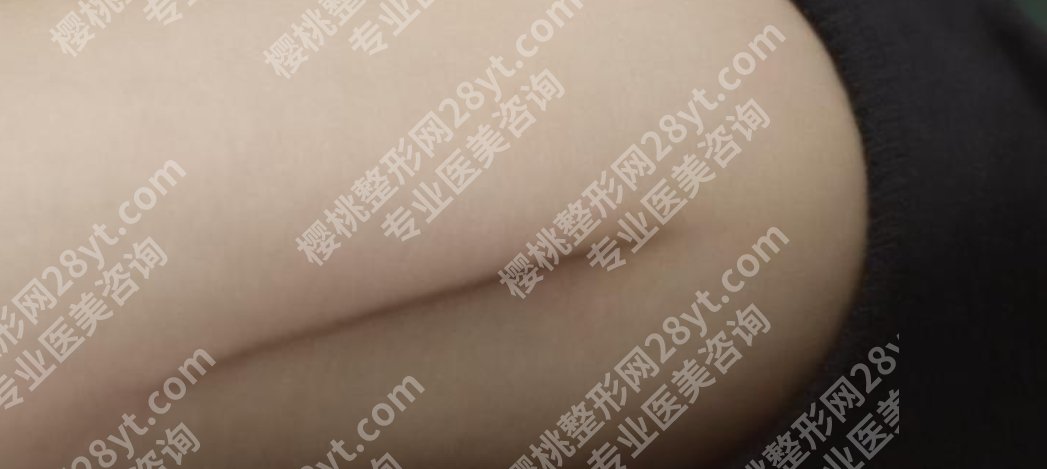 上海瑞金医院整形外科祛疤多少钱？医生团队资源分享！