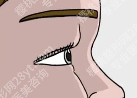 深圳鹏程医院做双眼皮好的医生有哪些？公布热门医生和顾客点评查看