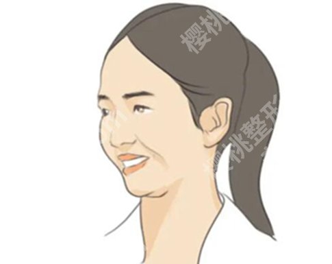 上海薇琳整形医院怎么样？优选医院资料和参考价格查看