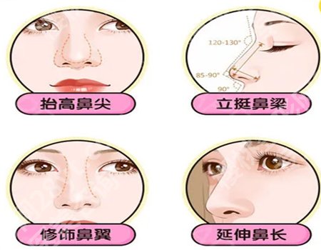 上海艺星做鼻子哪个医生好？项目价格更新，技术特点分析