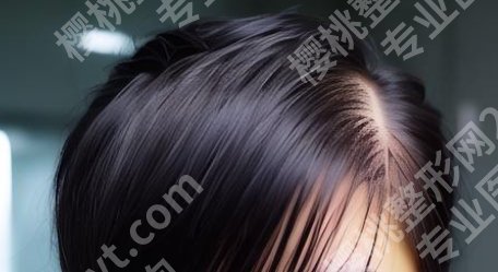 万禾丽生植发怎么样？真实的口碑点评及案例鉴赏！