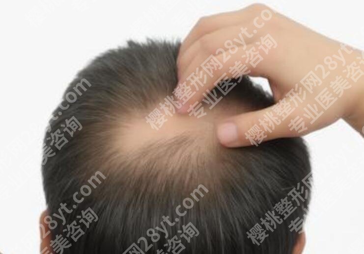 雍禾和碧莲盛哪个好？两家医院实力评比！来看详细介绍