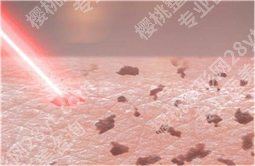 北京艺星激光怎么样？医院介绍，项目推荐