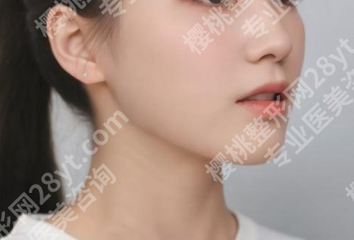 上海九院柴岗技术好吗？面部整形案例反馈|术后注意事项有哪些