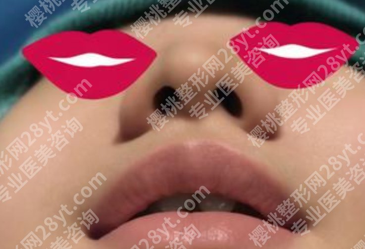 兰大一院美容整形科鼻头缩小的技术好不好？基本信息|一站式掌握