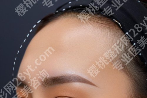 合肥韩美做脂肪填充额头多少钱？赵宇vs郑雪平医生信息盘点！