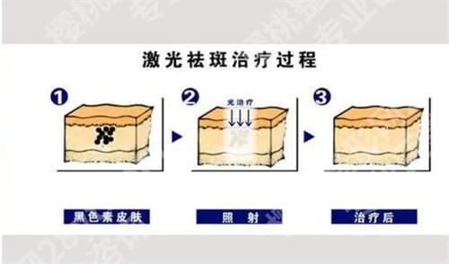 台州中心医院点阵激光怎么样？看技术实力点评