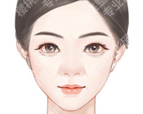 上海九院沈国芳正颌手术怎么样？公布医生资料，含擅长项目介绍