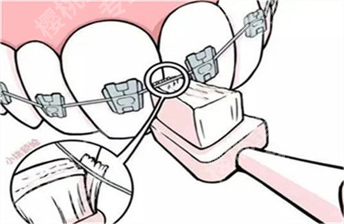 北京同仁医院看牙怎么样？一键查看医院信息