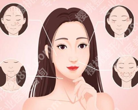 张晓健医生拉皮怎么样？点击查看医生简介和经典案例曝光