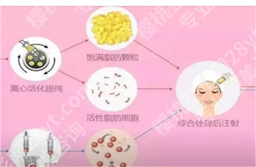 西安市中心医院脂肪填充怎么样？特色项目介绍，2024年价格公布