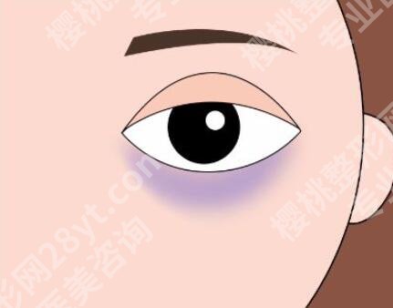 上海马刚医生祛黑眼圈怎么样？附上医生信息，分享小技巧一览