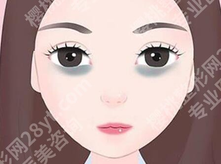 上海马刚医生祛黑眼圈怎么样？附上医生信息，分享小技巧一览