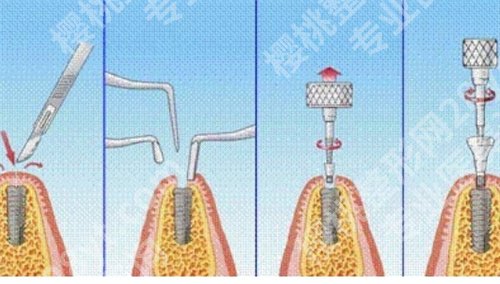 韶关第一人民医院牙科贵不贵？医院实力在线查看，点击围观