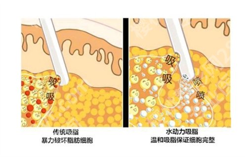 运城市中心医院整形科吸脂怎么样？看医院口碑、亮点介绍