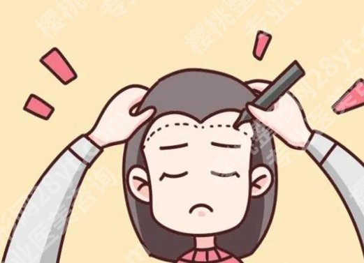 李宇飞植发成功率高吗？含医生资料和详细案例反馈