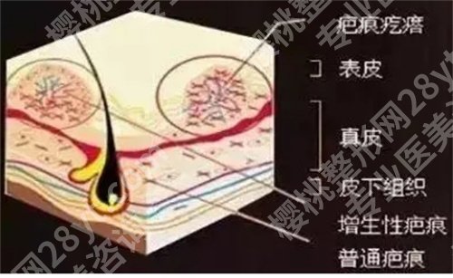 温州人民医院去疤痕专家实力怎么样？医院亮点，医生介绍