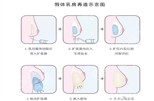 上海新华医院去眼袋多少钱？2024新版价格带你了解
