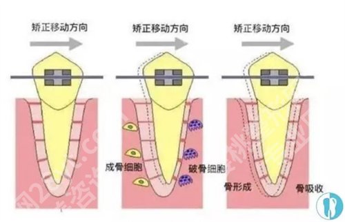 广州雅皓口腔种植牙怎么样?医院医院技术点评