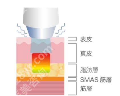 成都赫拉臻颜怎么样？医院热门项目有哪些？案例参考