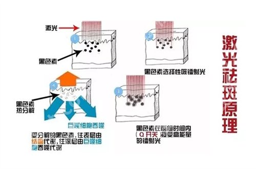 上海第十人民医院点阵激光多少钱？2024新资料介绍了