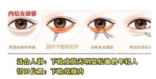 北京医院双眼皮医生有谁？一览医院基本信息介绍