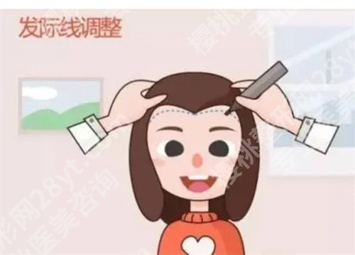 杭州第一人民医院植发案例在线预览！看口碑项目介绍