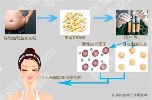 安徽医科大学第二附属医院双眼皮手术哪个做的比较好？看主要项目介绍