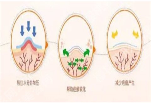佛山第一人民医院美容科治疤痕怎么样？附案例解说