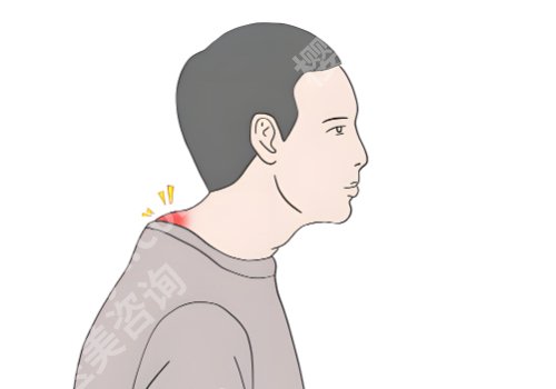 北京协和医院富贵包挂什么科？内附医院信息及项目介绍