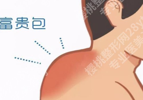 北京协和医院富贵包挂什么科？内附医院信息及项目介绍