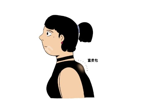 北京协和医院富贵包挂什么科？内附医院信息及项目介绍