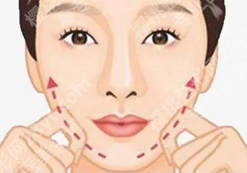 上海薇琳整形瘦脸怎么样？医院信息及项目一览