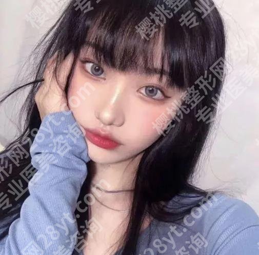 花都人民医院激光美容科可以打玻尿酸吗？揭晓科室资料和人气案例曝光