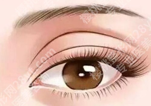 端木雪峰双眼皮做的咋样？分享医生信息及坐诊医院