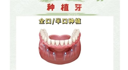 南京青苗口腔怎么样?医院主打项目介绍