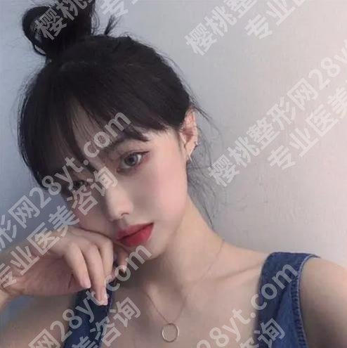 周兆平双眼皮案例怎么样？一键了解双眼皮详细过程
