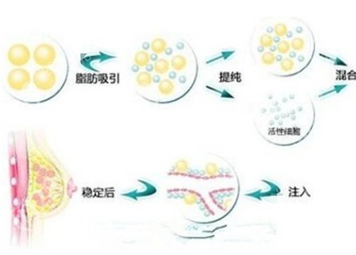 深圳美加美隆胸价格怎么样？医院详情介绍，口碑点评