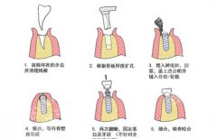 深圳美奥口腔医院地址在哪里？医院简介，项目推荐