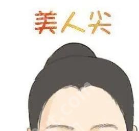 西安科大毛发医院是不是正规医院？医院植发技术好吗？参考价