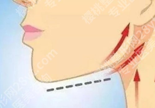 南京美莱和艺星哪家做轮廓固定更好?医院实力分析公布！选前必看
