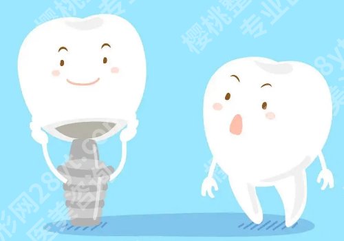 山东大学口腔医院种植牙哪个医生？张东姣、文勇、徐欣等医生上榜！
