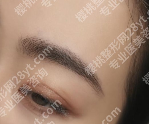 西京整形医院纹眉的技术好不好？医院技术优势分析！