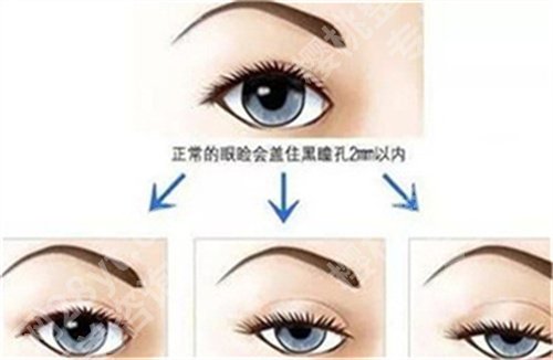 上海九院眼综合谁做得好？医院+医生详情介绍