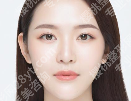 王衡健技术怎样？含医生技术如何，附参考价格