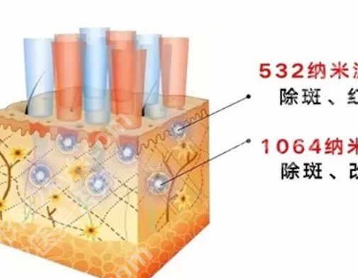 徐州二院点阵激光价格？2025年价格在线看