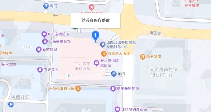 广元达芬奇割双眼皮的技术好不好?真实案例参考