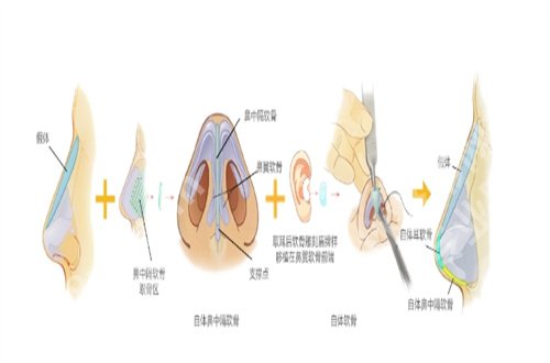 龙华人民医院点阵激光多少钱一次？科普知识整理了