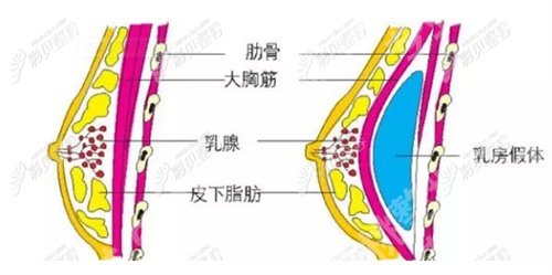 北京安贞医院隆胸价格是多少？医院简介一览
