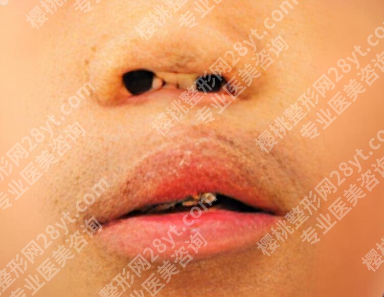 复旦大学附属儿科医院整形外科在几号楼？医院简介|价目表一览！